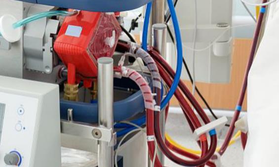 盆馬達電機反轉(zhuǎn)，盆馬達電機反轉(zhuǎn)原因及解決方法